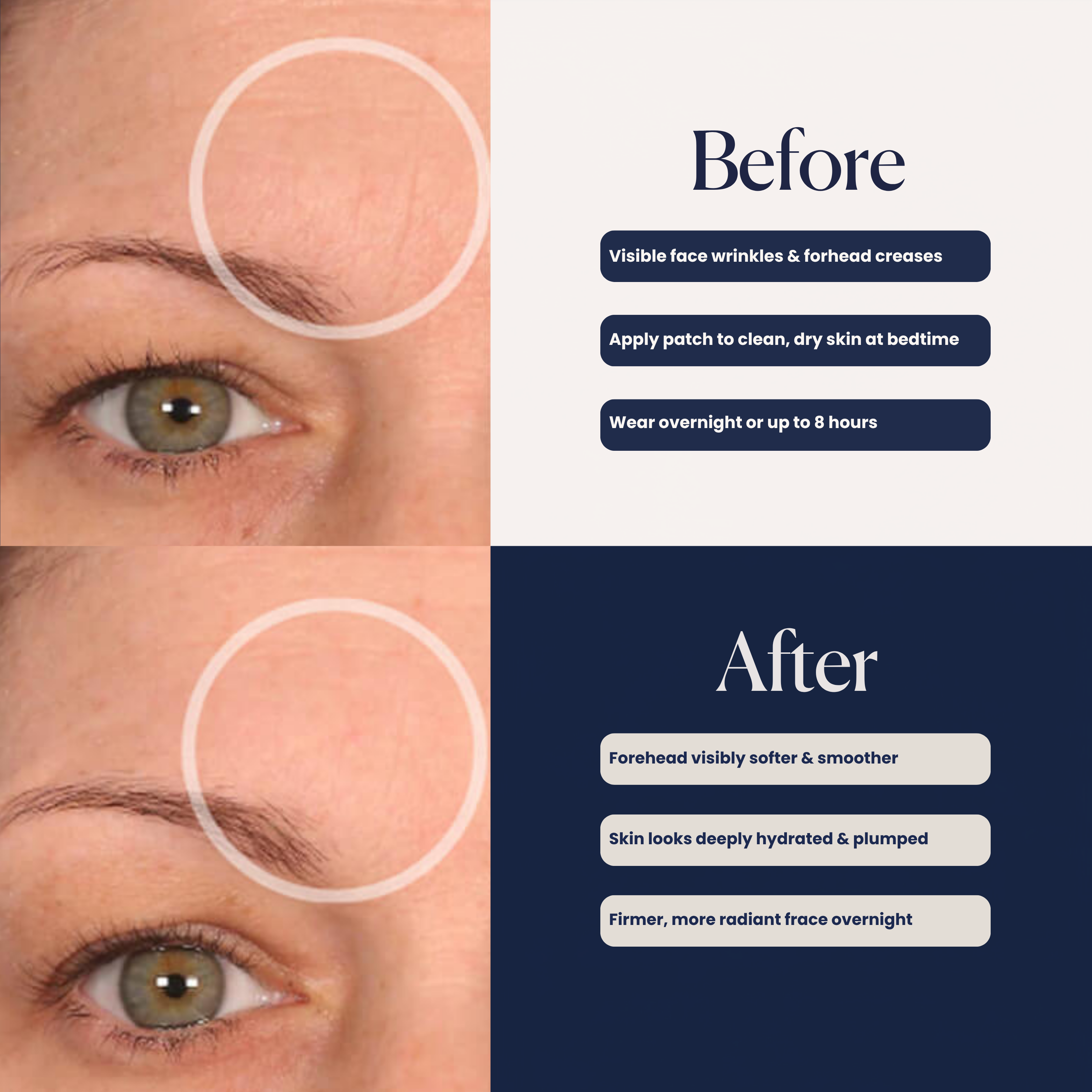 FaceLift Hydroseal™ Patches