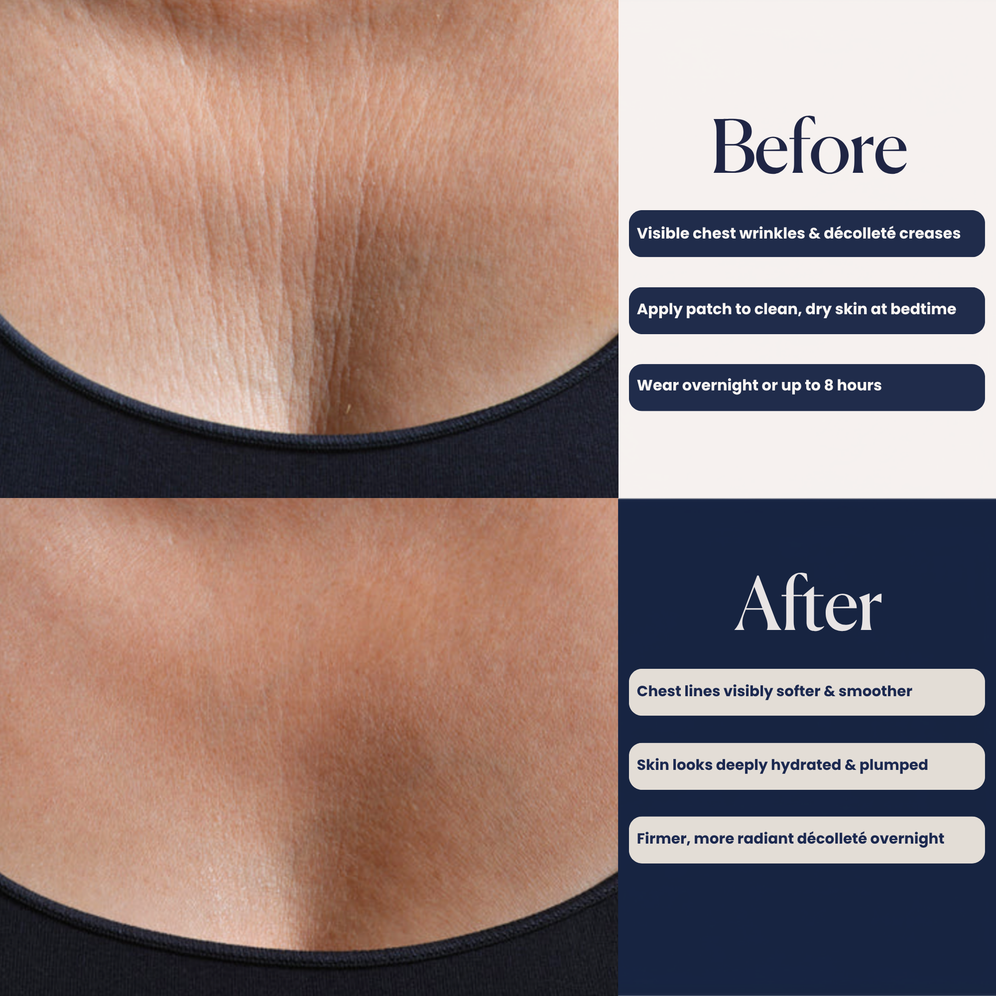 Chest Hydroseal™ Patch