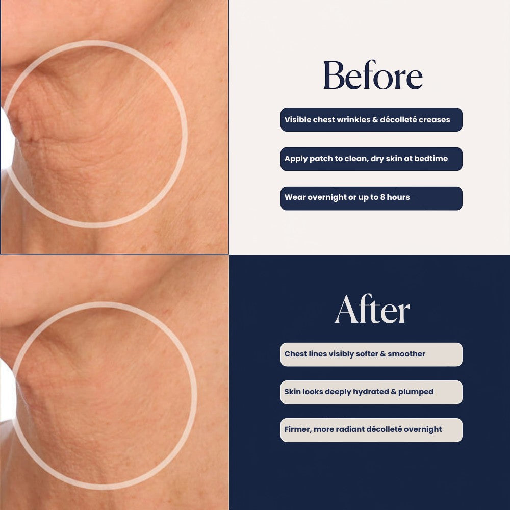 Neck Hydroseal™ Patch